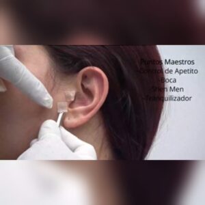 TERAPIAS ALTERNATIVAS (AURICULOTERAPIA, MEDICINA BIOLÓGICA, SUEROTERAPIA PARA EL CONTROL DE PESO Y DIETOTERAPIA)