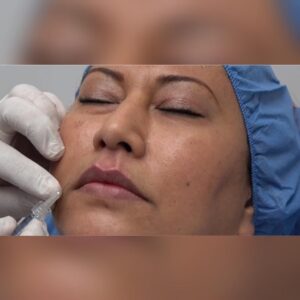 ÁCIDO HIALURÓNICO TÉCNICA CON MICRO AGUJA