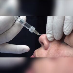 TÉCNICAS AVANZADAS CON ÁCIDO HIALURÓNICO