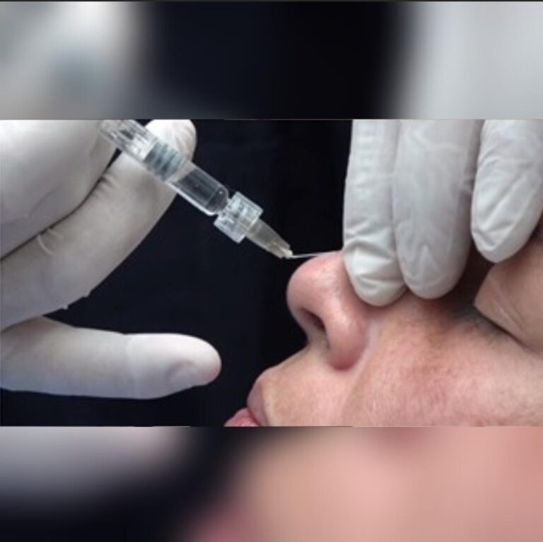 TÉCNICAS AVANZADAS CON ÁCIDO HIALURÓNICO